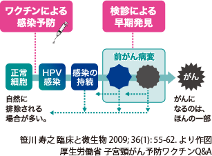ワクチンによる感染予防・検診による早期発見 | 正常細胞・HPV感染・感染の持続・前がん病変・がん | 笹川 寿之 臨床と微生物 2009; 36(1): 55-62. より作図、厚生労働省 子宮頸がん予防ワクチンQ&A