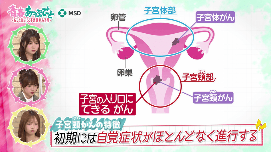 子宮頸がんの特徴 初期には自覚症状がほとんどなく進行する