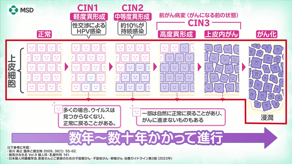 数年～数十年かかって進行