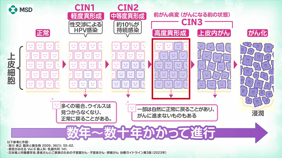 数年～数十年かかって進行